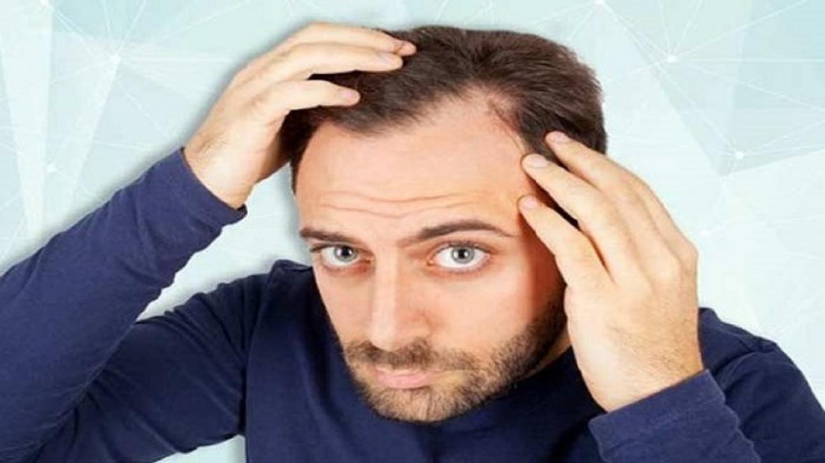 اگر نگران ریزش موی خود هستید، این چند نکته را جدی بگیرید