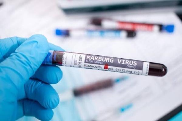 هشدار کشورهای عربی به مسافران درباره ویروس ماربورگ