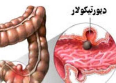 درمان بیماری دیورتیکولار با تغذیه مناسب